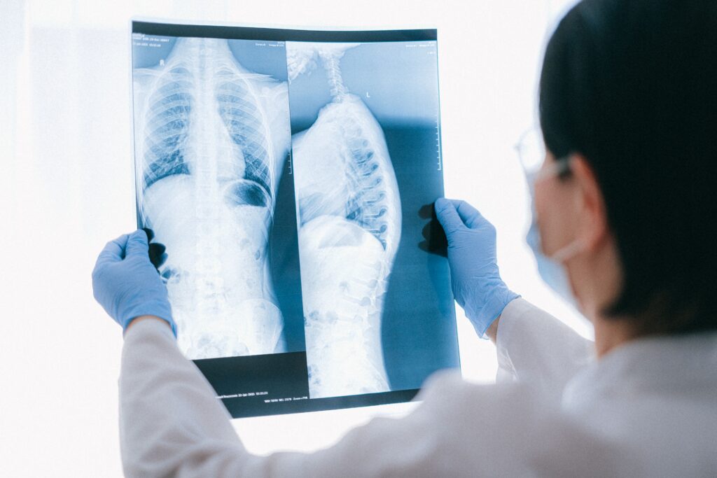 Seeking Damages for NY Car Accidents with Pre-Existing Conditions