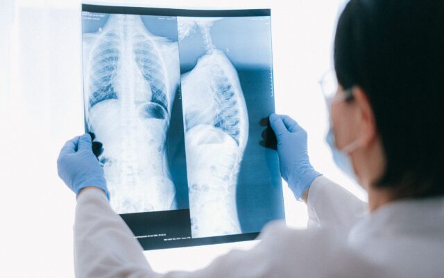 Seeking Damages for NY Car Accidents with Pre-Existing Conditions